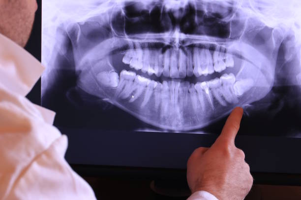 Best Emergency Dental Surgery in Manchester, MI