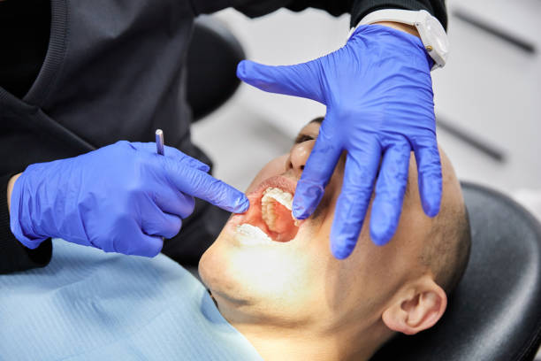 Best Emergency Wisdom Teeth Removal in Manchester, MI