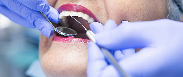 Best Emergency Tooth Extraction in Manchester, MI